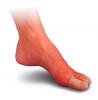 Silipos Digital Toe Finger Cap Foot Protectors
