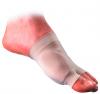Bunion Care Gel Protector Sleeve